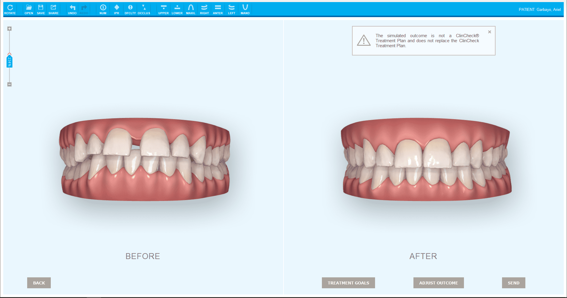 Invisalign Brasília - Clínica Odontológica Top Doctor #01